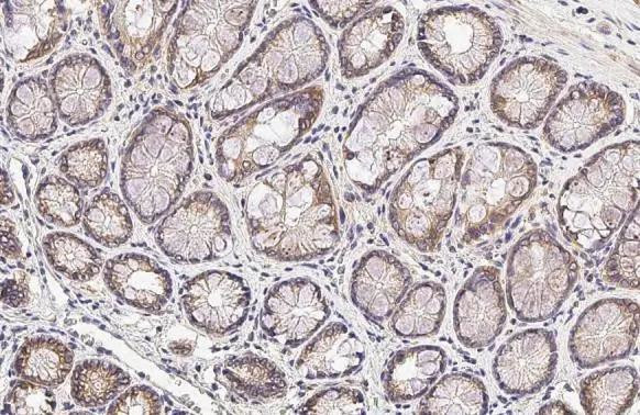 SIGIRR Antibody in Immunohistochemistry (Paraffin) (IHC (P))