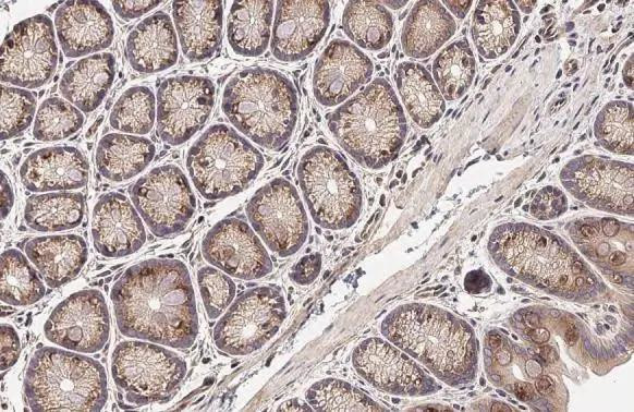 SIGIRR Antibody in Immunohistochemistry (Paraffin) (IHC (P))