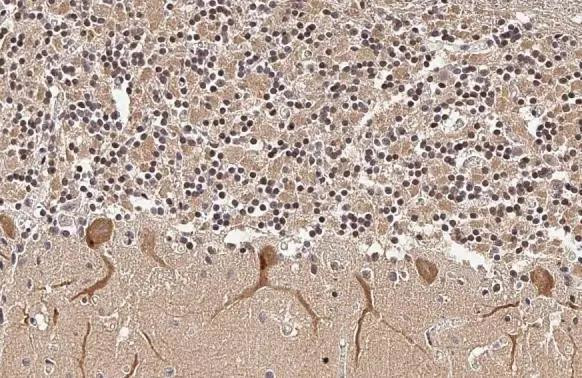 ISG15 Antibody in Immunohistochemistry (Paraffin) (IHC (P))