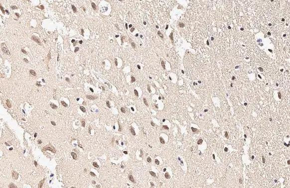 SOD1 Antibody in Immunohistochemistry (Paraffin) (IHC (P))