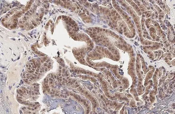 SOD1 Antibody in Immunohistochemistry (Paraffin) (IHC (P))