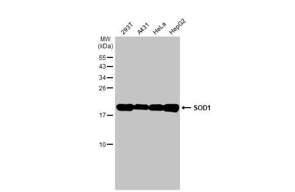 SOD1 Antibody in Western Blot (WB)