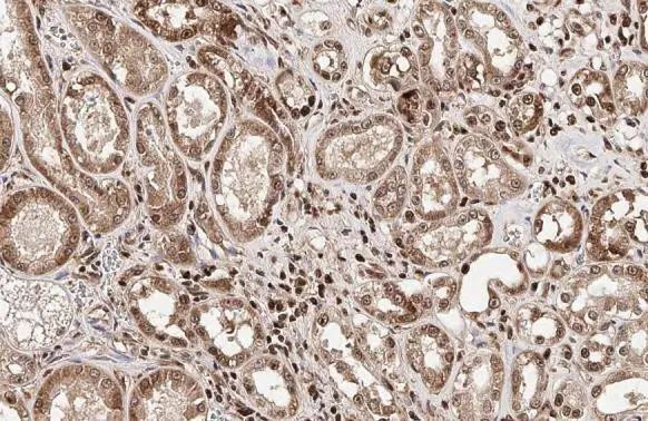 HMGB1 Antibody in Immunohistochemistry (Paraffin) (IHC (P))