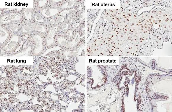 HMGB1 Antibody in Immunohistochemistry (Paraffin) (IHC (P))