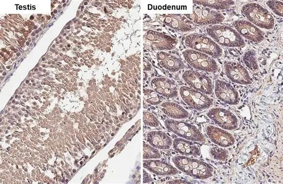 CDK6 Antibody in Immunohistochemistry (Paraffin) (IHC (P))