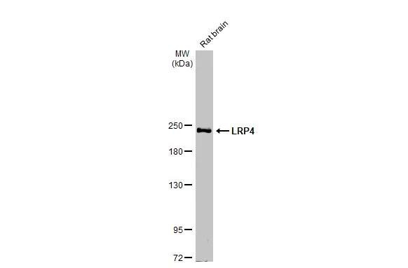 LRP4 Antibody in Western Blot (WB)