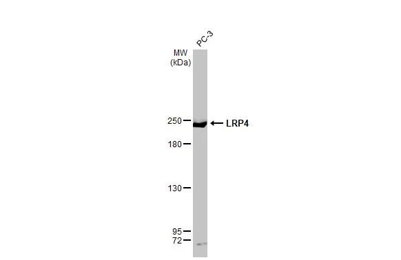 LRP4 Antibody in Western Blot (WB)