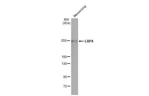 LRP4 Antibody in Western Blot (WB)