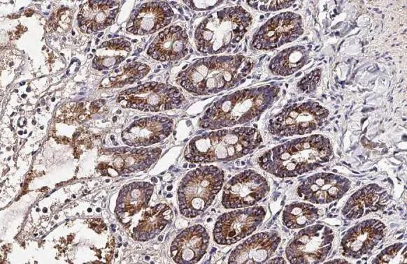 OAT Antibody in Immunohistochemistry (Paraffin) (IHC (P))