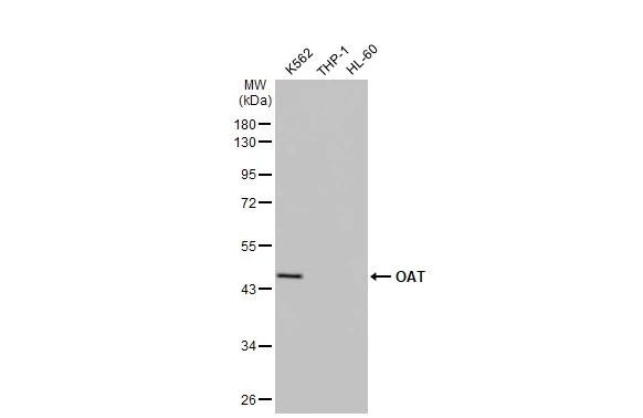 OAT Antibody in Western Blot (WB)