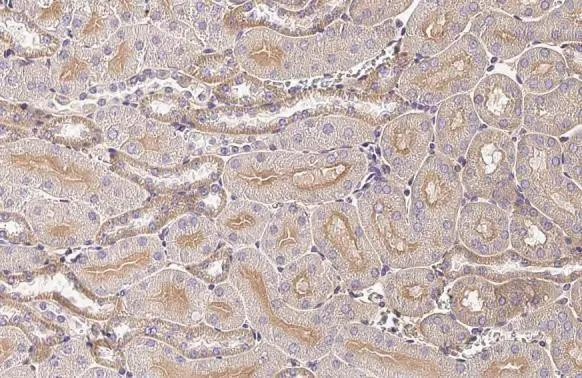 GNAI1/GNAI2/GNAI3 Antibody in Immunohistochemistry (Paraffin) (IHC (P))