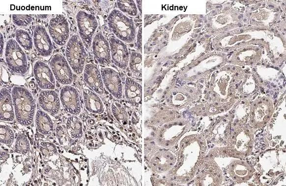 GNAI1/GNAI2/GNAI3 Antibody in Immunohistochemistry (Paraffin) (IHC (P))