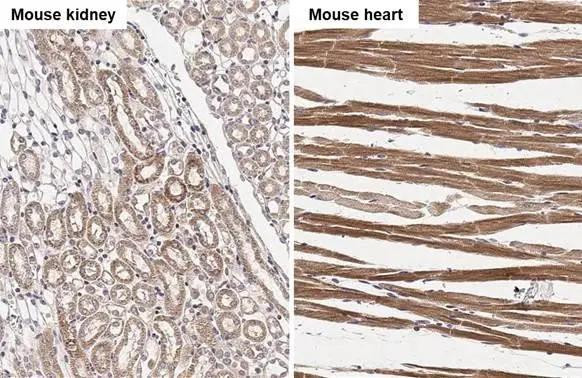 NDUFS3 Antibody in Immunohistochemistry (Paraffin) (IHC (P))