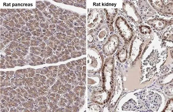 NDUFS3 Antibody in Immunohistochemistry (Paraffin) (IHC (P))