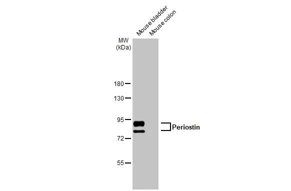 Periostin Antibody in Western Blot (WB)