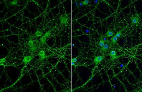 PIN1 Antibody in Immunocytochemistry (ICC/IF)