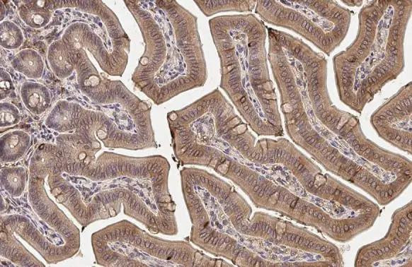 TPL2 Antibody in Immunohistochemistry (Paraffin) (IHC (P))