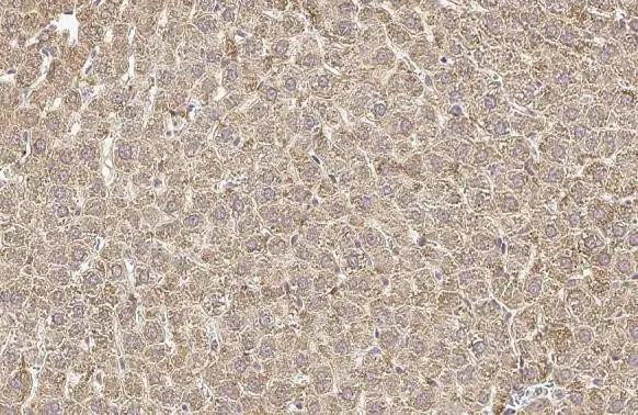 OTC Antibody in Immunohistochemistry (Paraffin) (IHC (P))