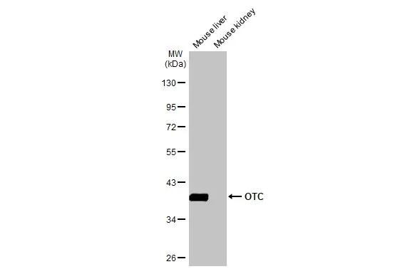 OTC Antibody in Western Blot (WB)