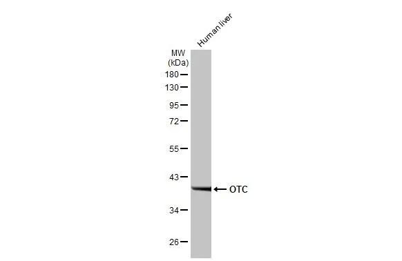 OTC Antibody in Western Blot (WB)