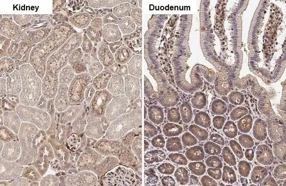 Annexin A1 Antibody in Immunohistochemistry (Paraffin) (IHC (P))