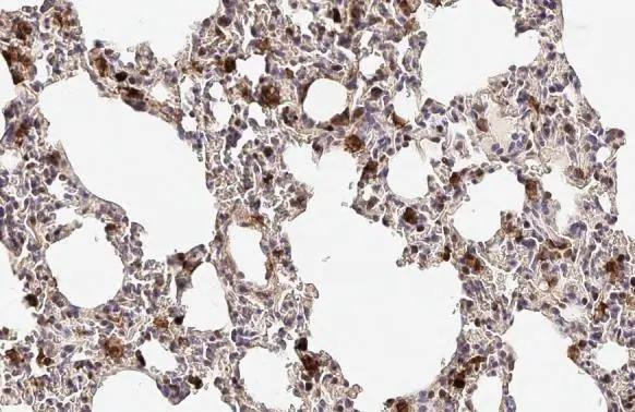 Annexin A1 Antibody in Immunohistochemistry (Paraffin) (IHC (P))