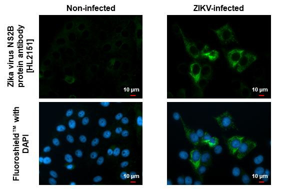 Zika Virus NS2B Antibody in Immunocytochemistry (ICC/IF)