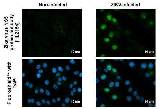 Zika Virus NS5 Antibody in Immunocytochemistry (ICC/IF)