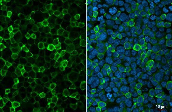 IBA1 Antibody in Immunocytochemistry (ICC/IF)