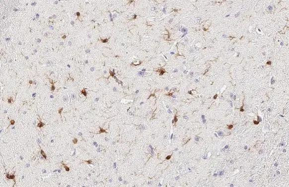 IBA1 Antibody in Immunohistochemistry (Paraffin) (IHC (P))