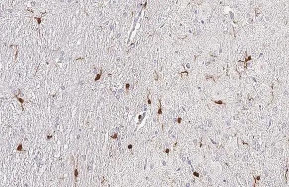 IBA1 Antibody in Immunohistochemistry (Paraffin) (IHC (P))