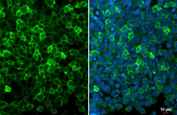 IBA1 Antibody in Immunocytochemistry (ICC/IF)