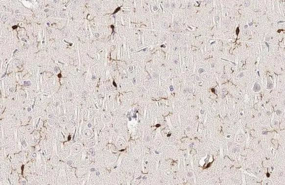 IBA1 Antibody in Immunohistochemistry (Paraffin) (IHC (P))