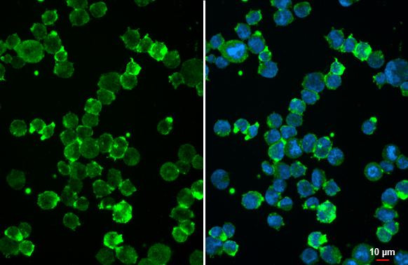 uPAR Antibody in Immunocytochemistry (ICC/IF)