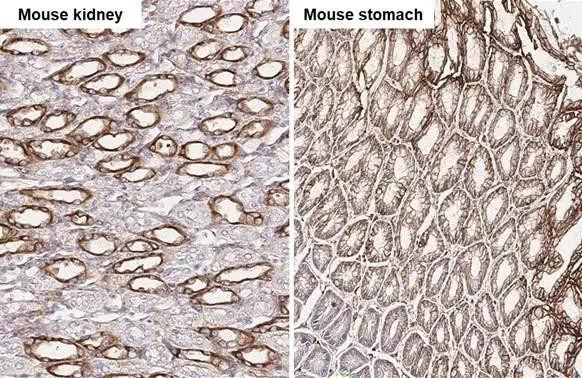 uPAR Antibody in Immunohistochemistry (Paraffin) (IHC (P))