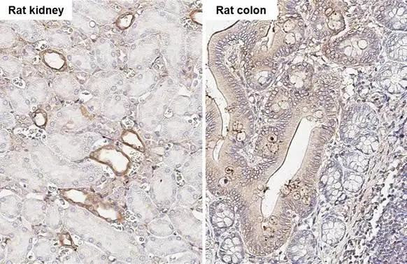 uPAR Antibody in Immunohistochemistry (Paraffin) (IHC (P))