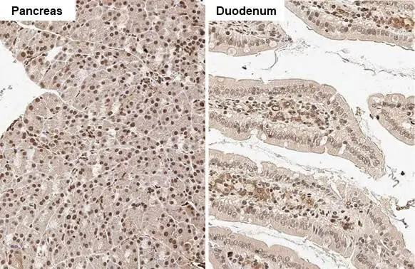 RAD21 Antibody in Immunohistochemistry (Paraffin) (IHC (P))