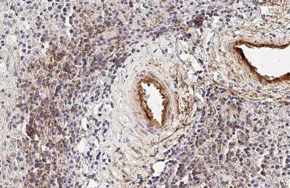 CXCL13 Antibody in Immunohistochemistry (Paraffin) (IHC (P))