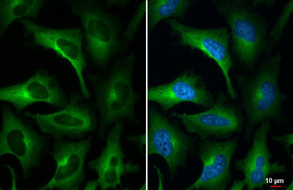 WNK1 Antibody in Immunocytochemistry (ICC/IF)