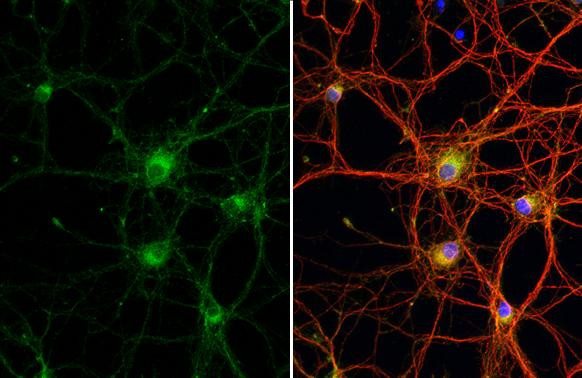 WNK1 Antibody in Immunocytochemistry (ICC/IF)