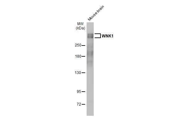 WNK1 Antibody in Western Blot (WB)