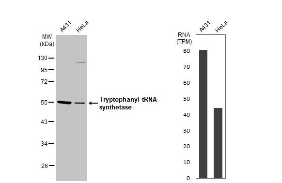 WARS Antibody in Western Blot (WB)