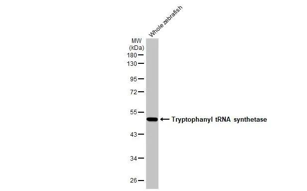 WARS Antibody in Western Blot (WB)