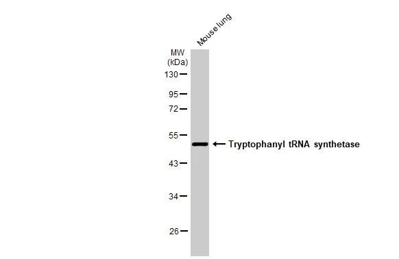 WARS Antibody in Western Blot (WB)