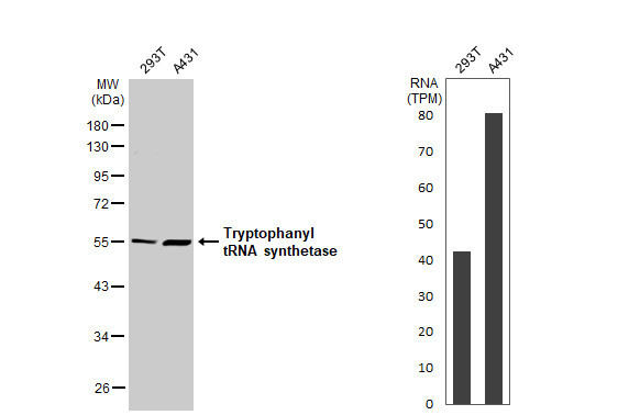 WARS Antibody in Western Blot (WB)