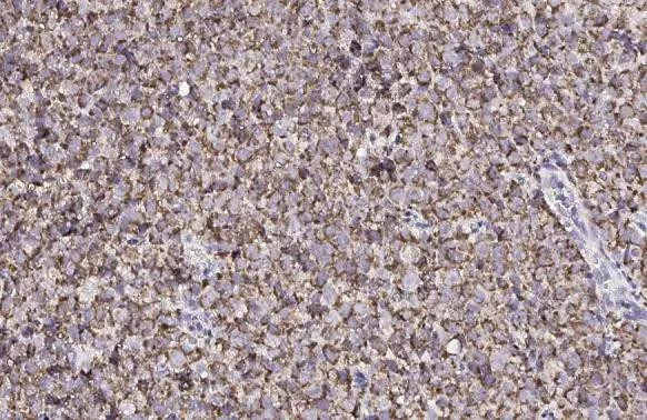 CXCR7 Antibody in Immunohistochemistry (Paraffin) (IHC (P))