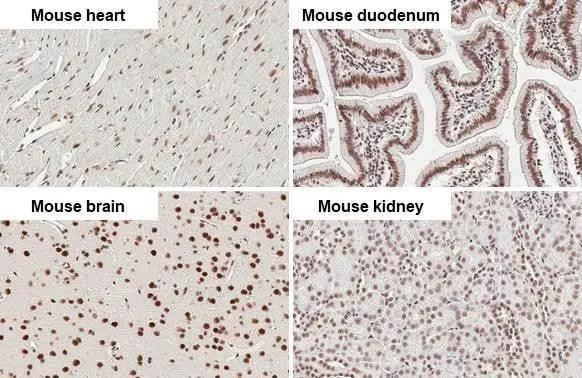 CBP Antibody in Immunohistochemistry (Paraffin) (IHC (P))