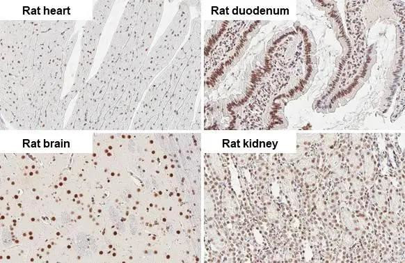 CBP Antibody in Immunohistochemistry (Paraffin) (IHC (P))