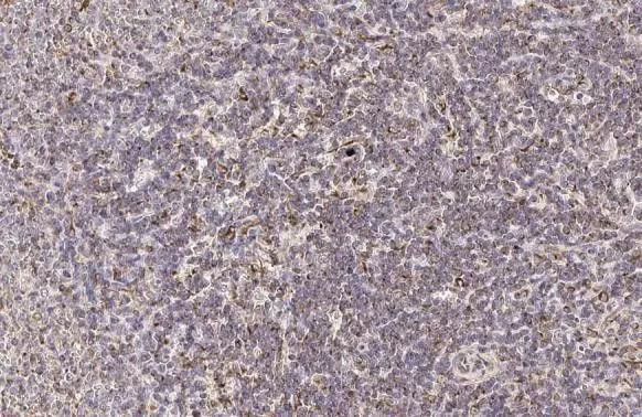 PFKFB4 Antibody in Immunohistochemistry (Paraffin) (IHC (P))