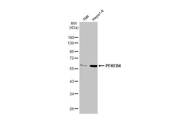 PFKFB4 Antibody in Western Blot (WB)